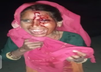 बरेली के थाना शाही के ग्राम बसावनपुर में पुलिस ने रात में दबिश के दौरान औरत को पीटकर  किया घायल -दरोगा सस्पेंड