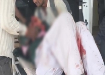 12वीं की नाबालिग छात्रा पर कटर से हमला, पेपर दे कर लौट रही थी छात्रा, थाना मकरोनिया का मामला